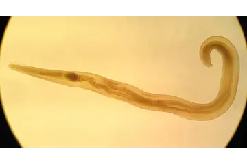 Rüyada Kıl Kurdu Görmek Anlamı ve Rüya Yorumu